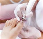 Pedicure