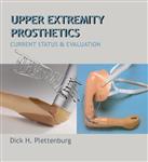Upper Extremity Prosthetics