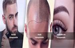 Haartransplantatie – Hasci