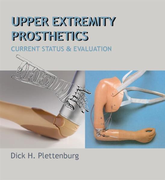 Grote foto upper extremity prosthetics boeken overige boeken