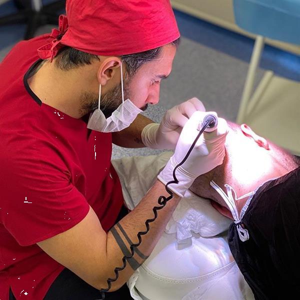 Grote foto fue haartransplantatie diensten en vakmensen haartransplantatie