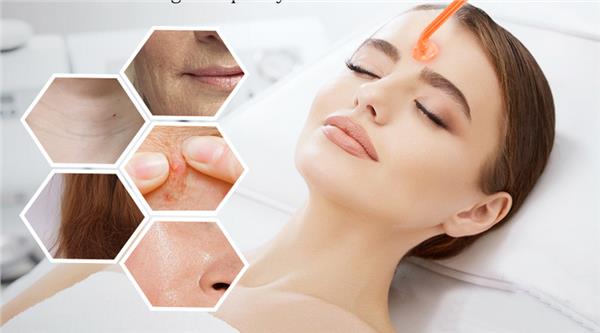 Grote foto skin therapy wand portable high frequency beauty en gezondheid gezichtsverzorging